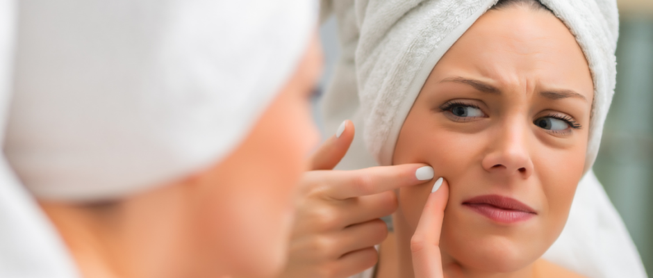hormones and pimples, acne causes, acne treatment, cortisol skin effects, androgen acne link, pimples from stress, manage hormonal acne, natural pimple remedies, stress acne prevention, hormone imbalance skin, acne stress solutions, stress and acne, hormones and pimples, acne causes, acne treatment