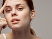 basic skincare for acne, daily routine to avoid pimples, natural acne prevention, skincare for oily skin, how to stop acne outbreaks, easy skin care regimen, pimple prevention habits, anti-acne daily routine, gentle cleansing for skin, moisturizing without clogging pores