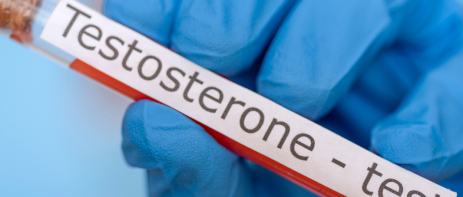 Testosterone health benefits, low testosterone symptoms, boost testosterone naturally, men’s hormonal health, testosterone level testing