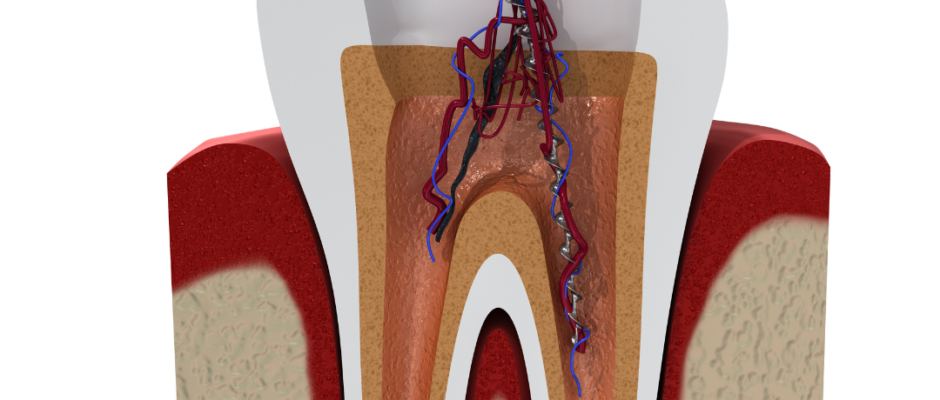 root canal cost, root canal price, cost of root canal, price of root canal treatment, dental root canal cost, root canal treatment cost, endodontic cost, tooth root canal price, average root canal cost, molar root canal cost