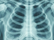 cold air chest hurt, why chest hurts in cold, cold weather chest discomfort, winter breathing pain, dry air chest irritation, bronchoconstriction cold air