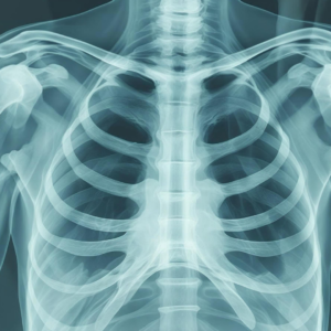 cold air chest hurt, why chest hurts in cold, cold weather chest discomfort, winter breathing pain, dry air chest irritation, bronchoconstriction cold air