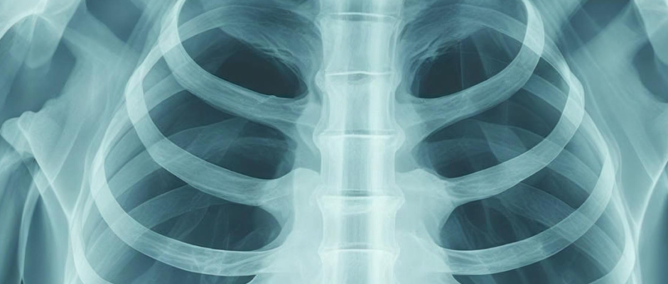 cold air chest hurt, why chest hurts in cold, cold weather chest discomfort, winter breathing pain, dry air chest irritation, bronchoconstriction cold air