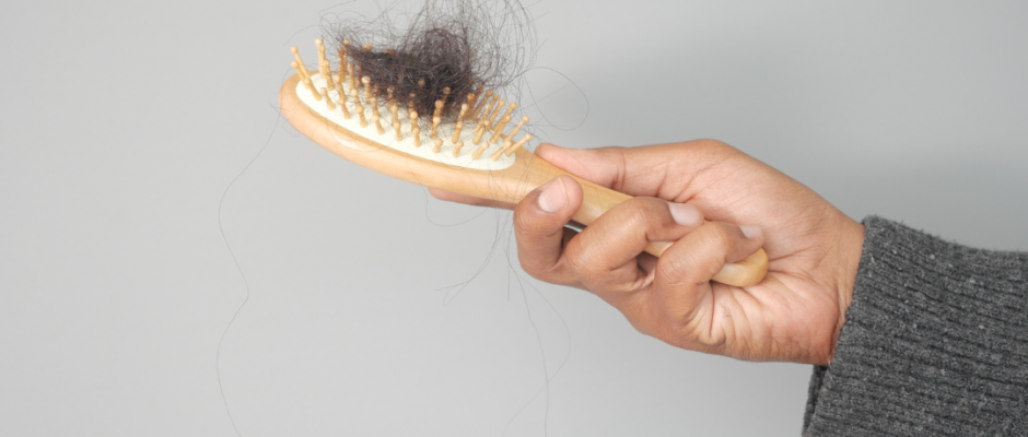 hair loss in winter, hair fall during winter months, scalp health winter, telogen effluvium winter, winter hair breakage