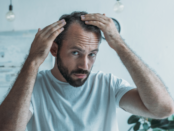Prevent Hair Loss in Men