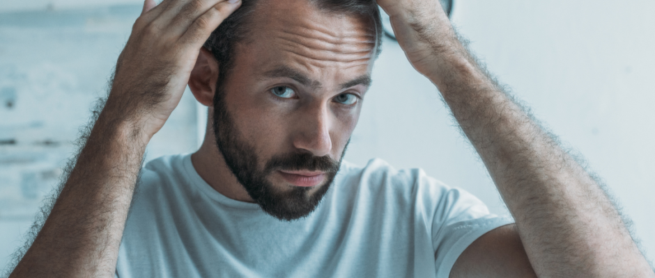 Prevent Hair Loss in Men