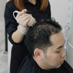 Male Hair Loss