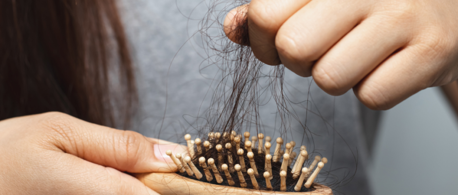 Hair falling out much