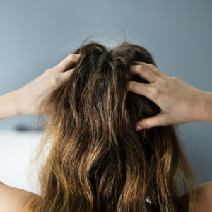 Excessive hair loss, hair shedding causes, why hair falls out, stop hair loss, hair thinning reasons, prevent hair shedding