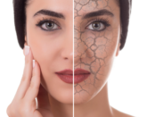 Shield skin pollutants UV, skin protection pollution, sun damage prevention, healthy skin care, UV skin defense