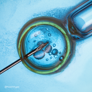 IVF process explained, factors affecting IVF, improving IVF outcomes, fertility clinic selection, IVF age impact, embryo transfer success, fertility treatment costs, secondary infertility solutions, reproductive health tips, natural fertility boosters