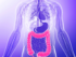 Is bloating related to IBS or food intolerance