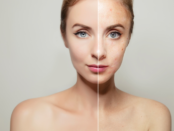Clear skin tips, acne prevention, healthy skin diet, skincare routine, natural skin remedies, teen acne solutions, skin hydration, reduce acne fast, skin cleansing, face mask benefits