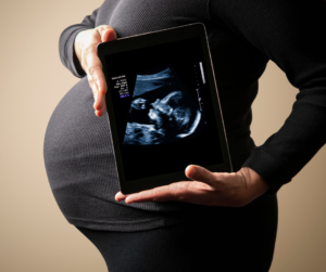 Folic acid benefits, iron supplements pregnancy, calcium during pregnancy, vitamin D pregnancy, omega-3 pregnancy benefits, prenatal folate, iron deficiency, fetal bone development, brain development, prenatal supplement guide, pregnancy health, nutrient deficiencies, prenatal care, maternal nutrition, DHA benefits