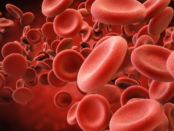 Blood type health risks, blood group health impact, blood type disease risks, blood type wellness, blood group health factors