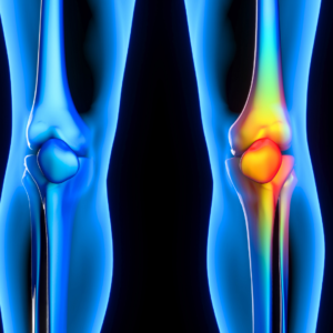 Bone health after STDs, strengthen bones post-STDs, bone recovery after STDs Secondary Keywords: Bone health, STD recovery, osteoporosis prevention, bone density, calcium-rich diet, vitamin D, exercise for bones, STD complications, bone strength, healthy bones