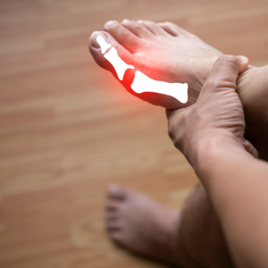 Gout flare relief, gout pain management, treat gout attacks, gout remedies, gout relief strategies