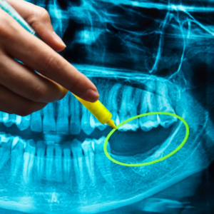dental radiographs, oral x-rays, dental imaging