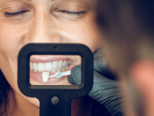 Ceramic veneers, dental shells, tooth coverings, laminate veneers