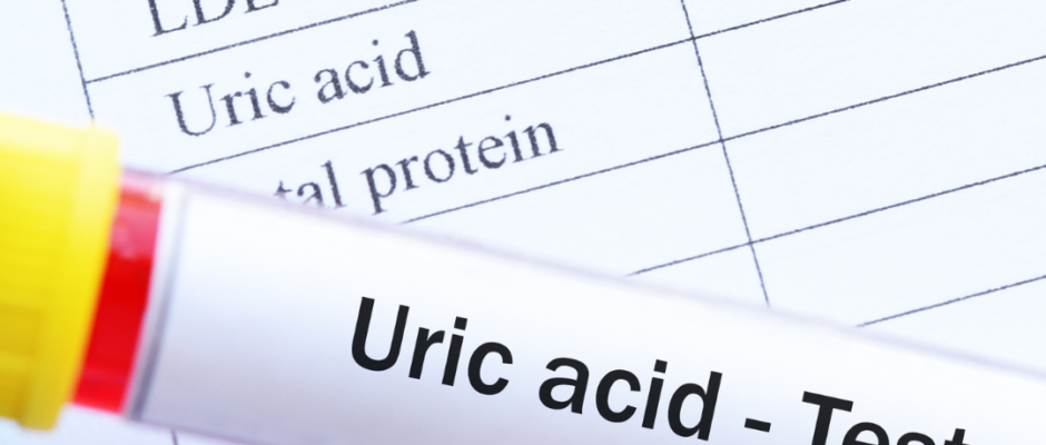 metabolic syndrome, kidney stones, joint pain, purine metabolism, low-purine diet, gout treatment, heart disease risk, brain health