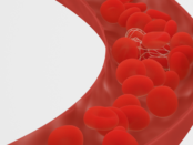 blood clot prevention