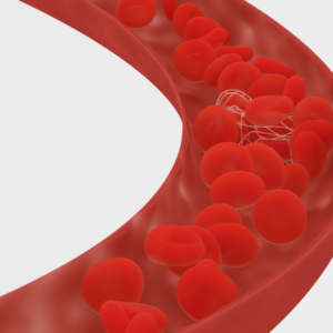 blood clot prevention