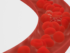 blood clot prevention