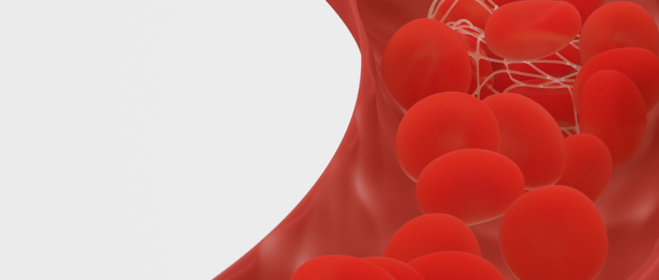 blood clot prevention
