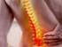 spinal cord damage, back trauma, vertebral fracture, sciatica causes, whiplash recovery, herniated disc treatment, spinal stenosis symptoms, paraplegia management, tetraplegia care, spine rehabilitation techniques
