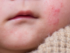 common infection symptoms, fever inflammation rash, organ specific signs, laboratory testing infections, blood tests cultures PCR, serology diagnostics, imaging biopsy infections, differential diagnosis infections, noninfectious causes mimicry, emerging infections 2025, infection symptoms guide, diagnostic tests overview