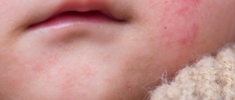 common infection symptoms, fever inflammation rash, organ specific signs, laboratory testing infections, blood tests cultures PCR, serology diagnostics, imaging biopsy infections, differential diagnosis infections, noninfectious causes mimicry, emerging infections 2025, infection symptoms guide, diagnostic tests overview