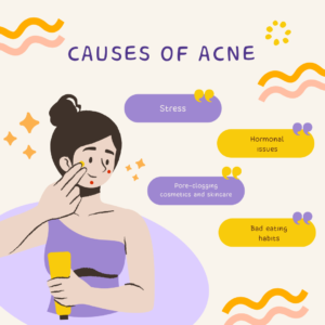 hormones and pimples, acne causes, acne treatment, cortisol skin effects, androgen acne link, pimples from stress, manage hormonal acne, natural pimple remedies, stress acne prevention, hormone imbalance skin, acne stress solutions, stress and acne, hormones and pimples, acne causes, acne treatment