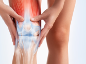 Image showing inflamed arteritis in the leg due to arteritis