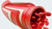 Poor circulation, blood flow, circulation-boosting foods, cardiovascular health, natural remedies for circulation, exercise for blood flow, lifestyle changes for circulation