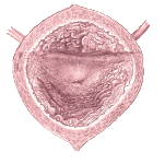 What is a Cystocele? Droopy or Fallen Bladder in Females - Healthhype