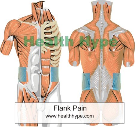 Flank  definition of flank by Medical dictionary
