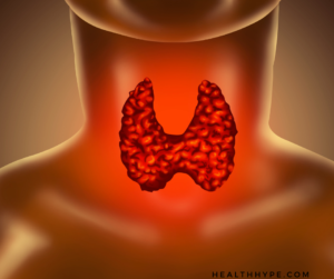 detailed illustration of the thyroid gland in the human neck with surrounding anatomy