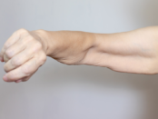 A close-up of a woman’s arm, showing reduced muscle definition and potential muscle loss.